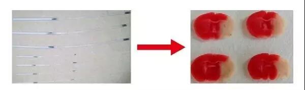 1-腦中風(fēng)模型.jpg