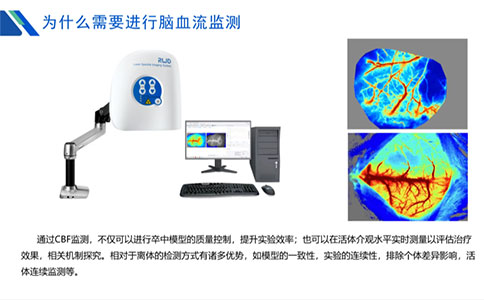 為什么需要進行腦血流監測？