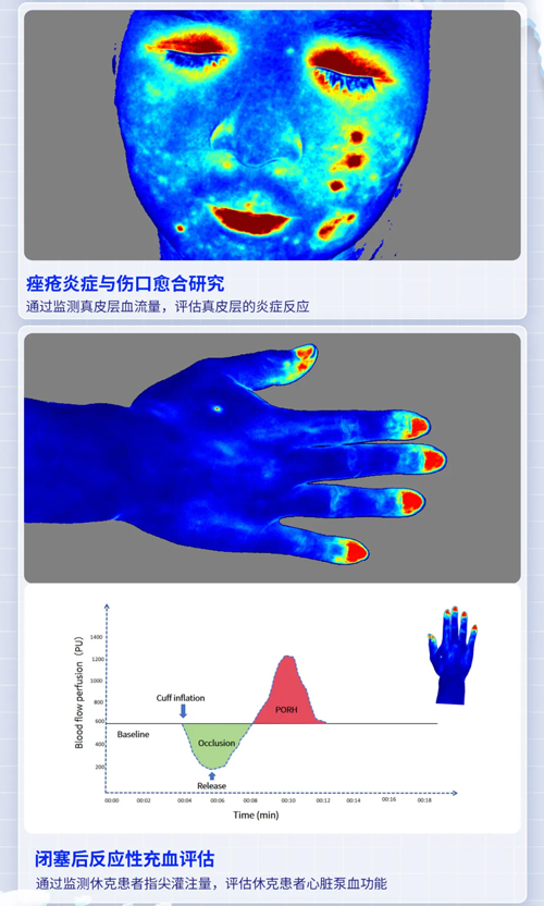 瑞沃德激光散斑血流成像系統(tǒng)獲批FDA認(rèn)證